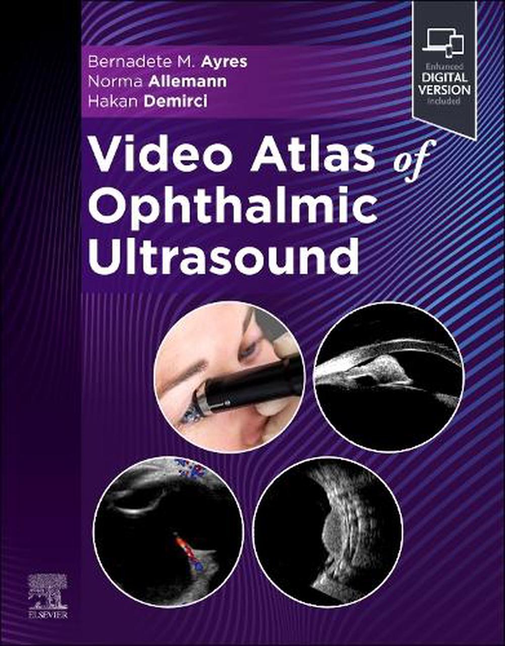 Video Atlas of Ophthalmic Ultrasound, 9780443107122