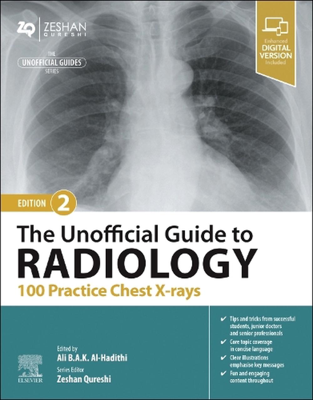 The Unofficial Guide to Radiology: 100 Practice Chest X-rays, 2nd Edition, 9780443109171