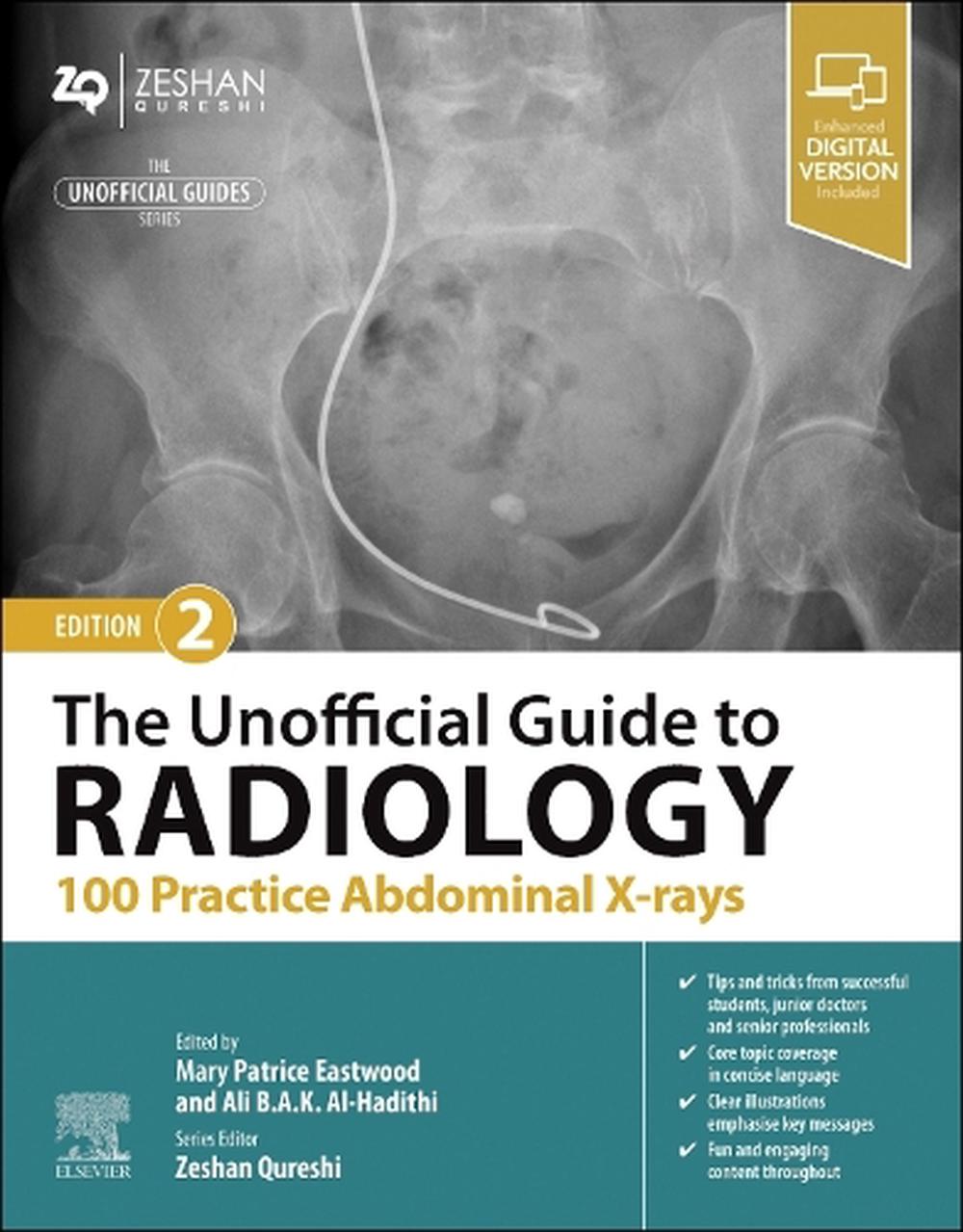 The Unofficial Guide to Radiology: 100 Practice Abdominal X-rays, 2nd Edition, 9780443109188