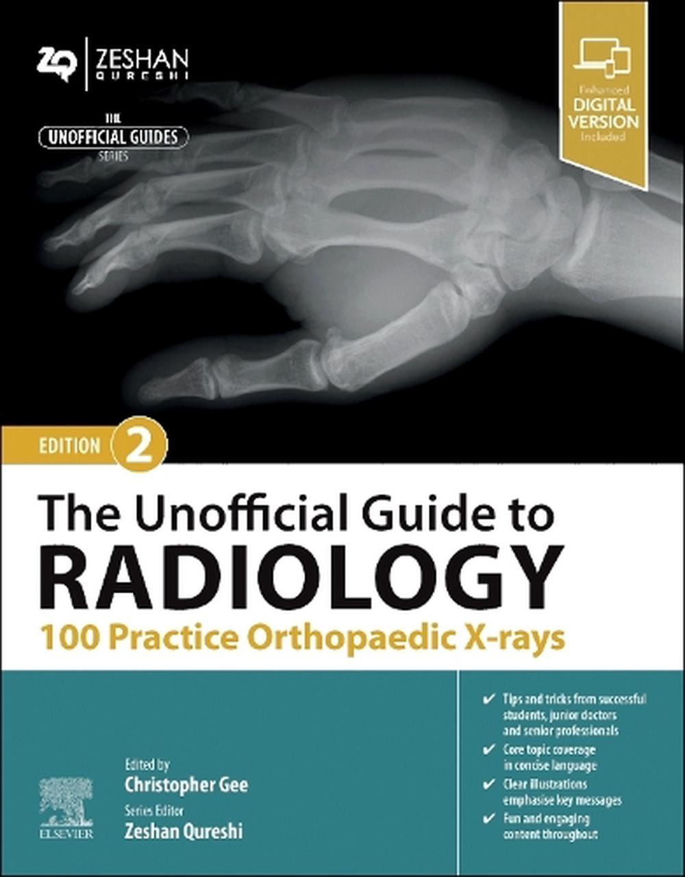 The Unofficial Guide to Radiology: 100 Practice Orthopaedic X-rays, 2nd Edition, 9780443109195