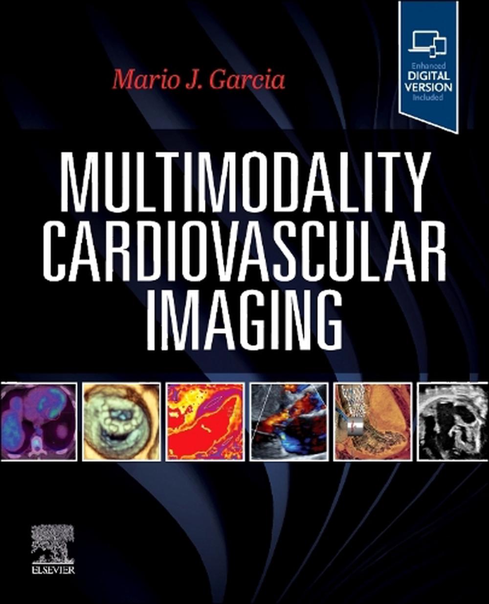 Multimodality Cardiovascular Imaging, 9780443115141
