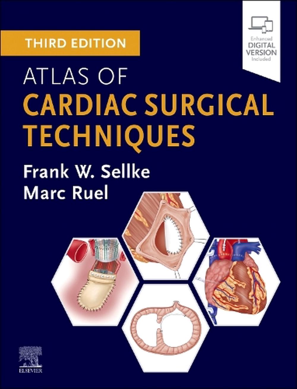 Atlas of Cardiac Surgical Techniques, 9780443118470