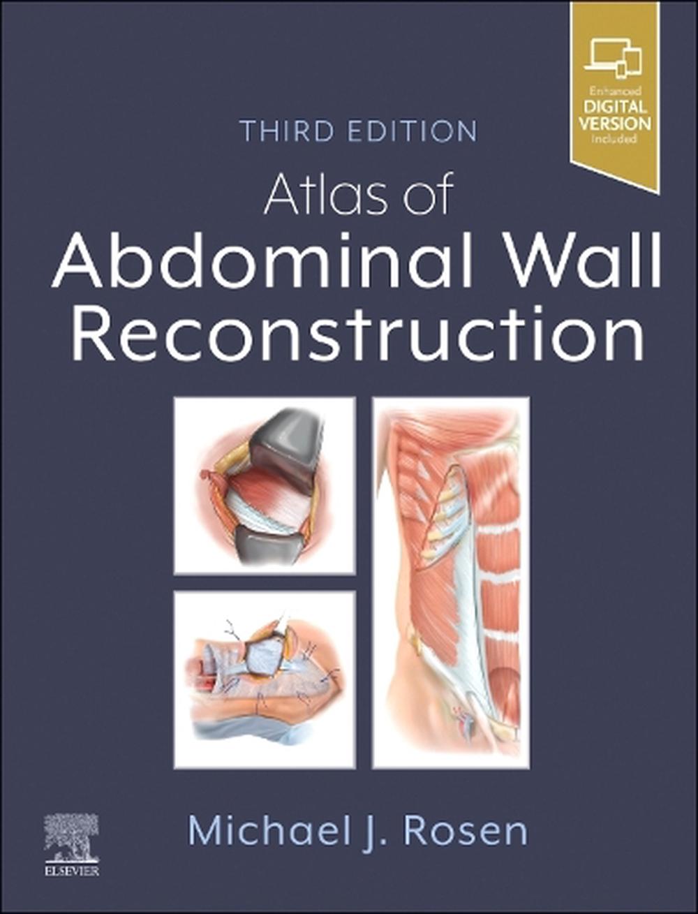 Atlas of Abdominal Wall Reconstruction, 9780443118500