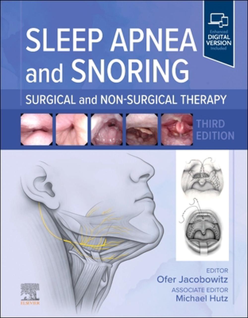 Sleep Apnea and Snoring, 9780443125638