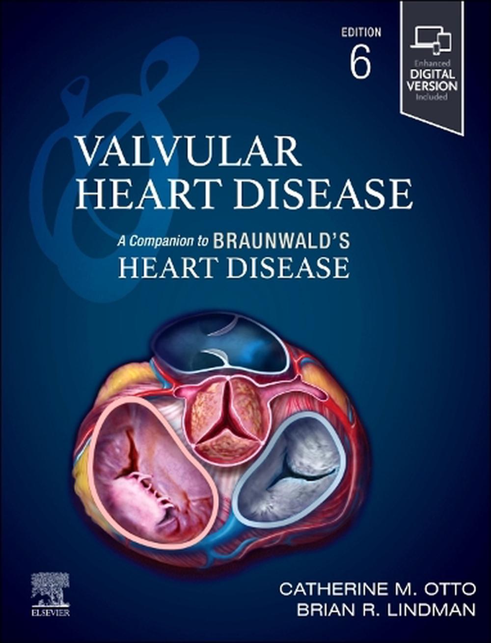 Valvular Heart Disease: A Companion to Braunwald's Heart Disease, 6th Edition by Catherine M. Otto - ISBN: 9780443126888