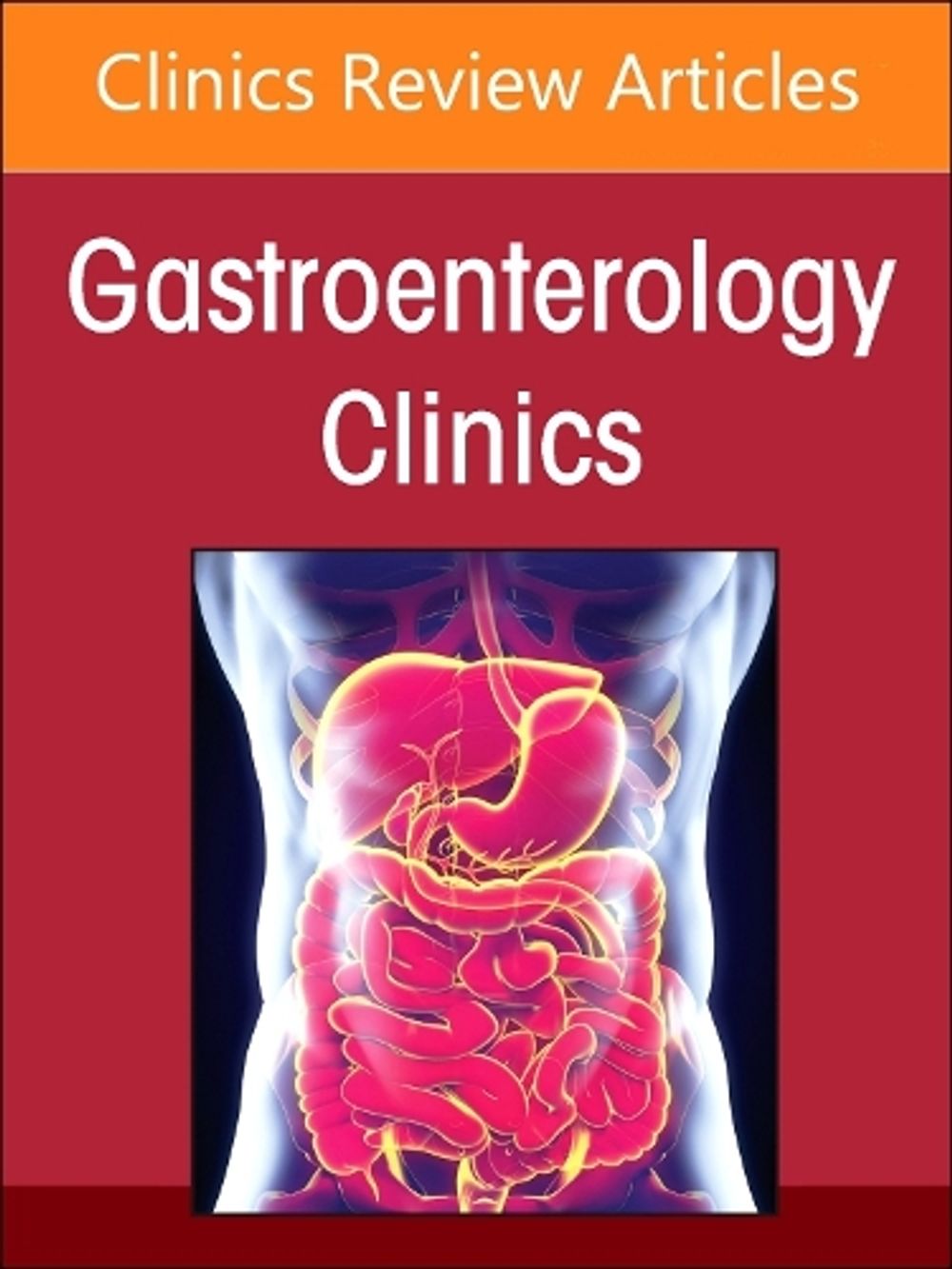 Advances in Intestinal Transplantation, Part II, An Issue of Gastroenterology Clinics of North America by Alan L. Buchman - ISBN: 9780443131417