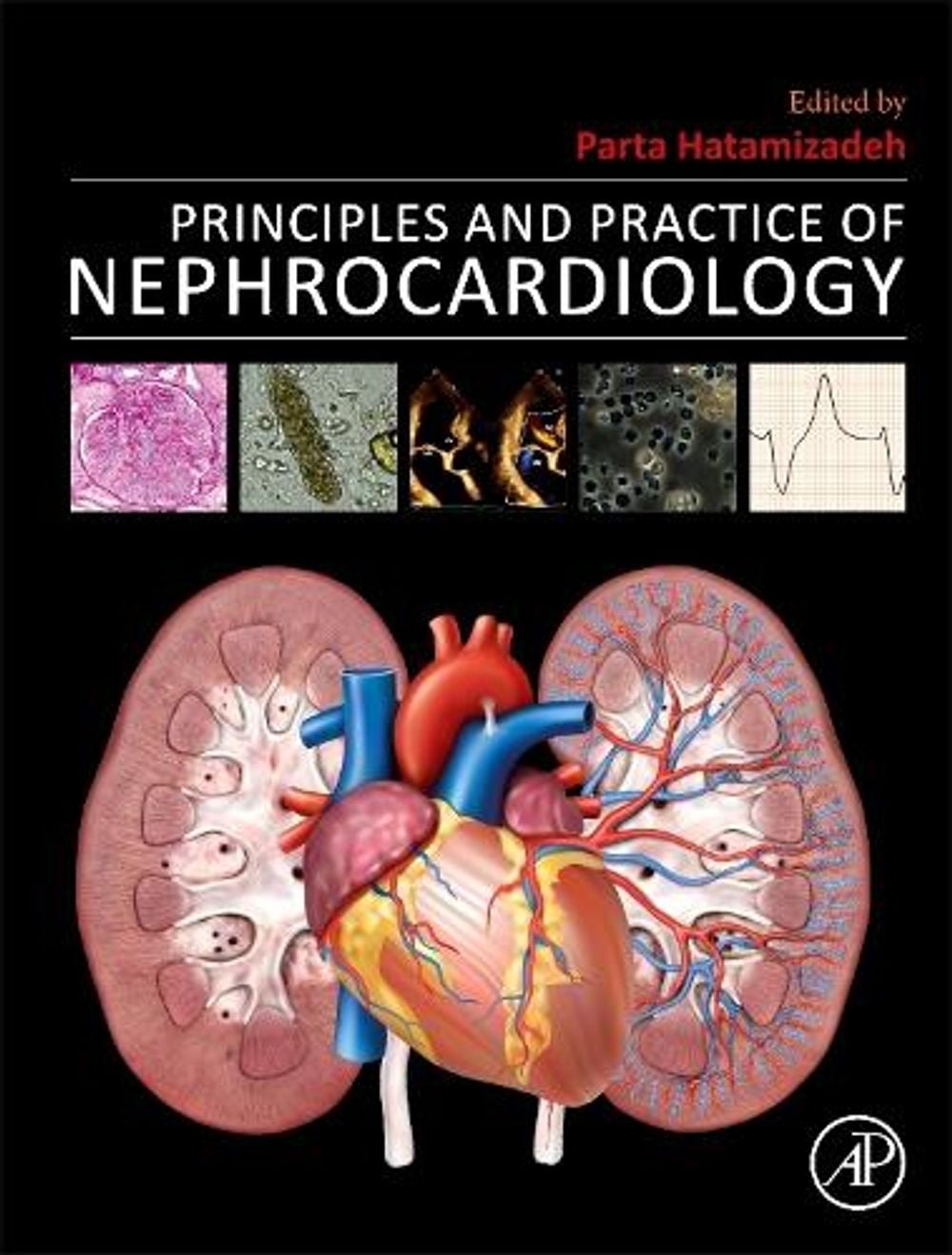Principles and Practice of Nephrocardiology by Parta Hatamizadeh - ISBN: 9780443156663