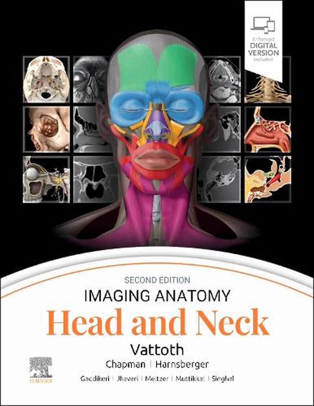 Imaging Anatomy: Head and Neck, 2nd Edition, 9780443249648