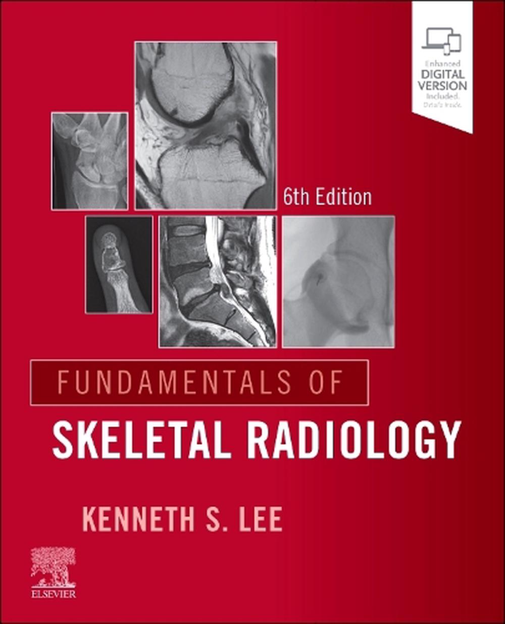 Fundamentals of Skeletal Radiology, 6th Edition, 9780443264542