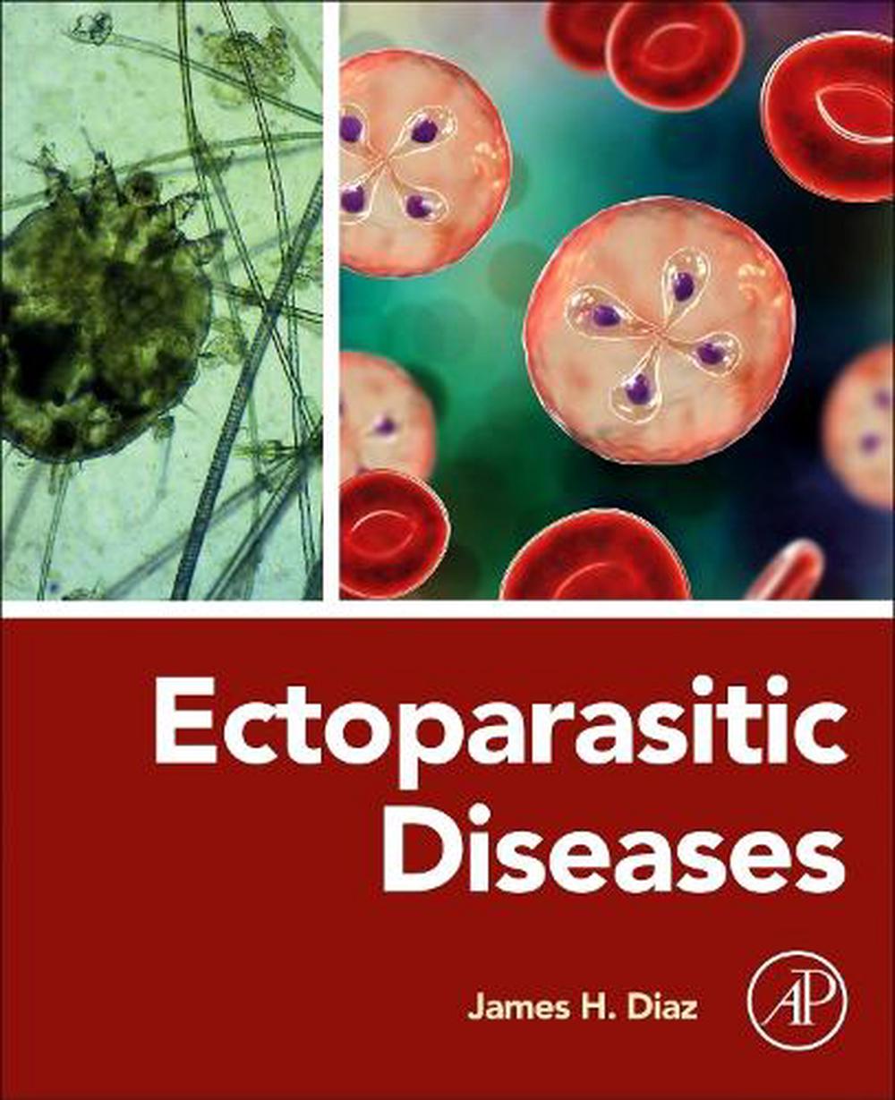 Ectoparasitic Diseases by James H. Diaz - ISBN: 9780443267246