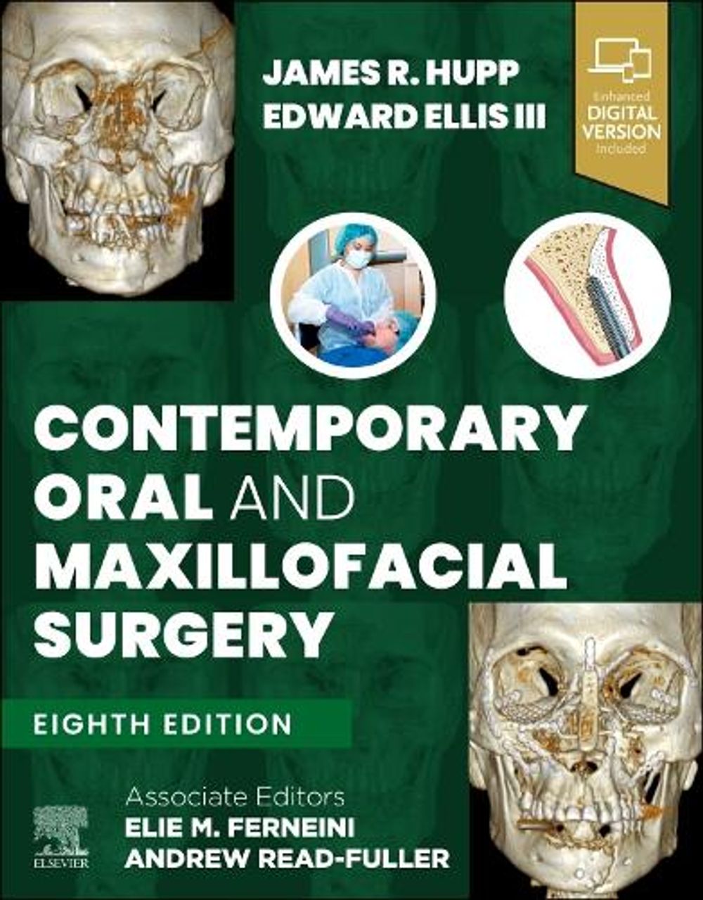 Contemporary Oral and Maxillofacial Surgery, 8th Edition by James R. Hupp - ISBN: 9780443268885