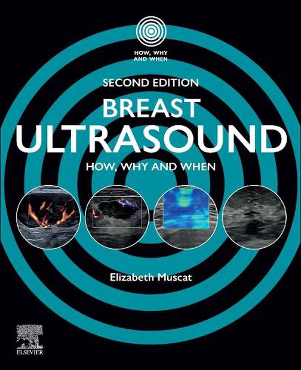 Breast Ultrasound, 2nd Edition, 9780443278488