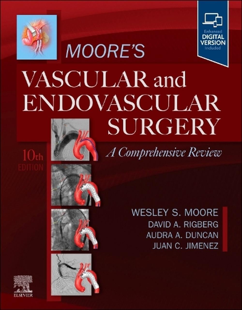 Moore's Vascular and Endovascular Surgery: A Comprehensive Review, 10th Edition by Wesley S. Moore - ISBN: 9780443284328