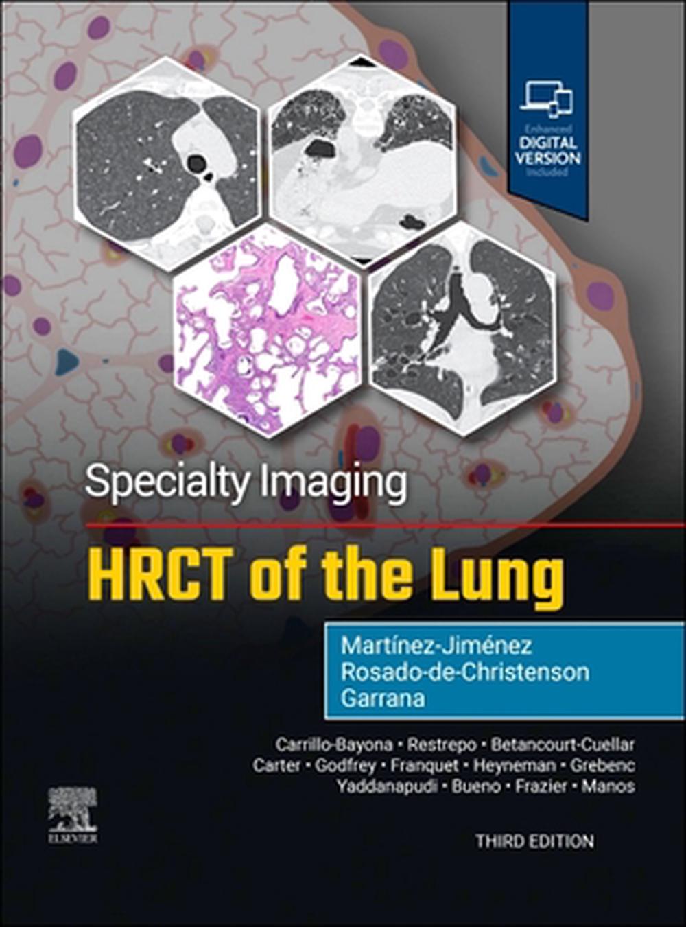 Specialty Imaging: HRCT of the Lung, 9780443286360