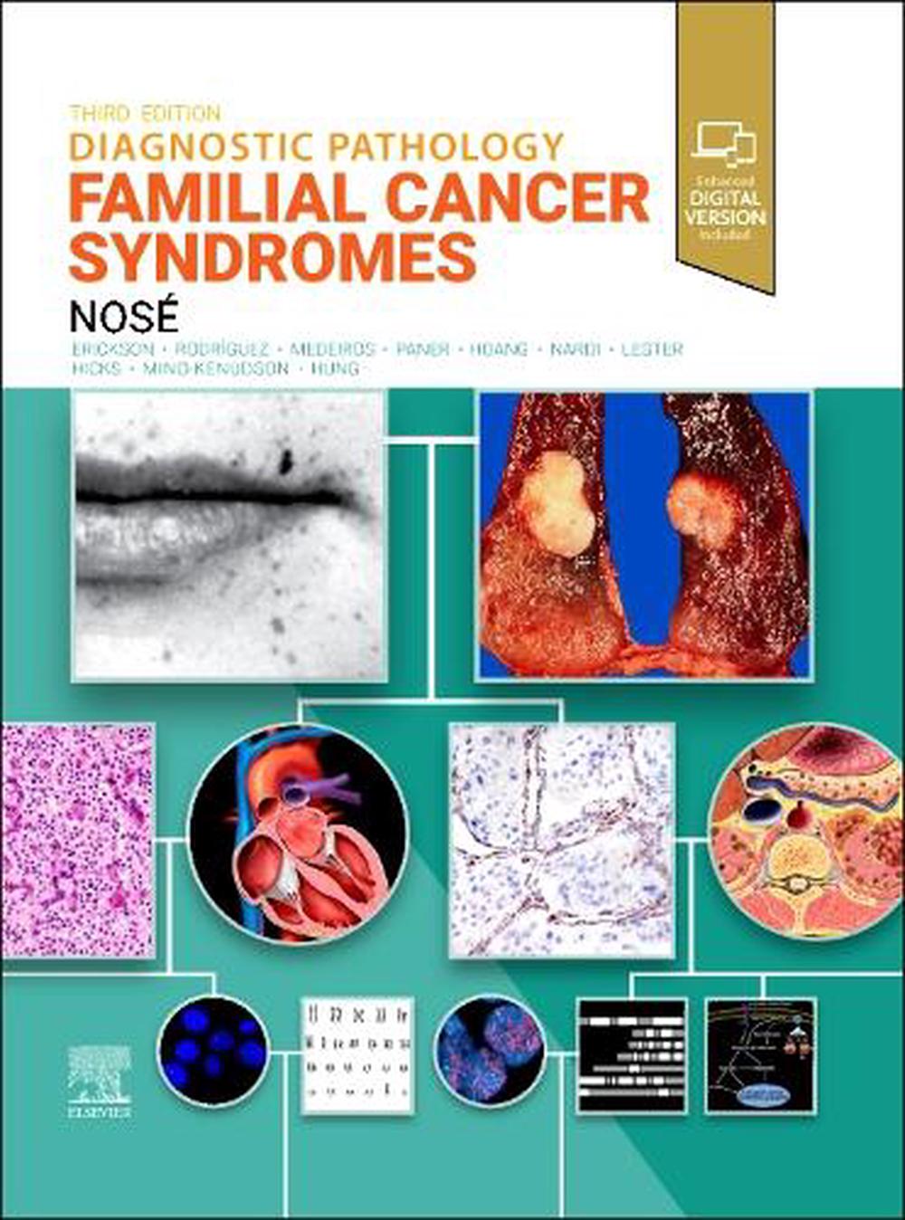 Diagnostic Pathology: Familial Cancer Syndromes, 9780443286407