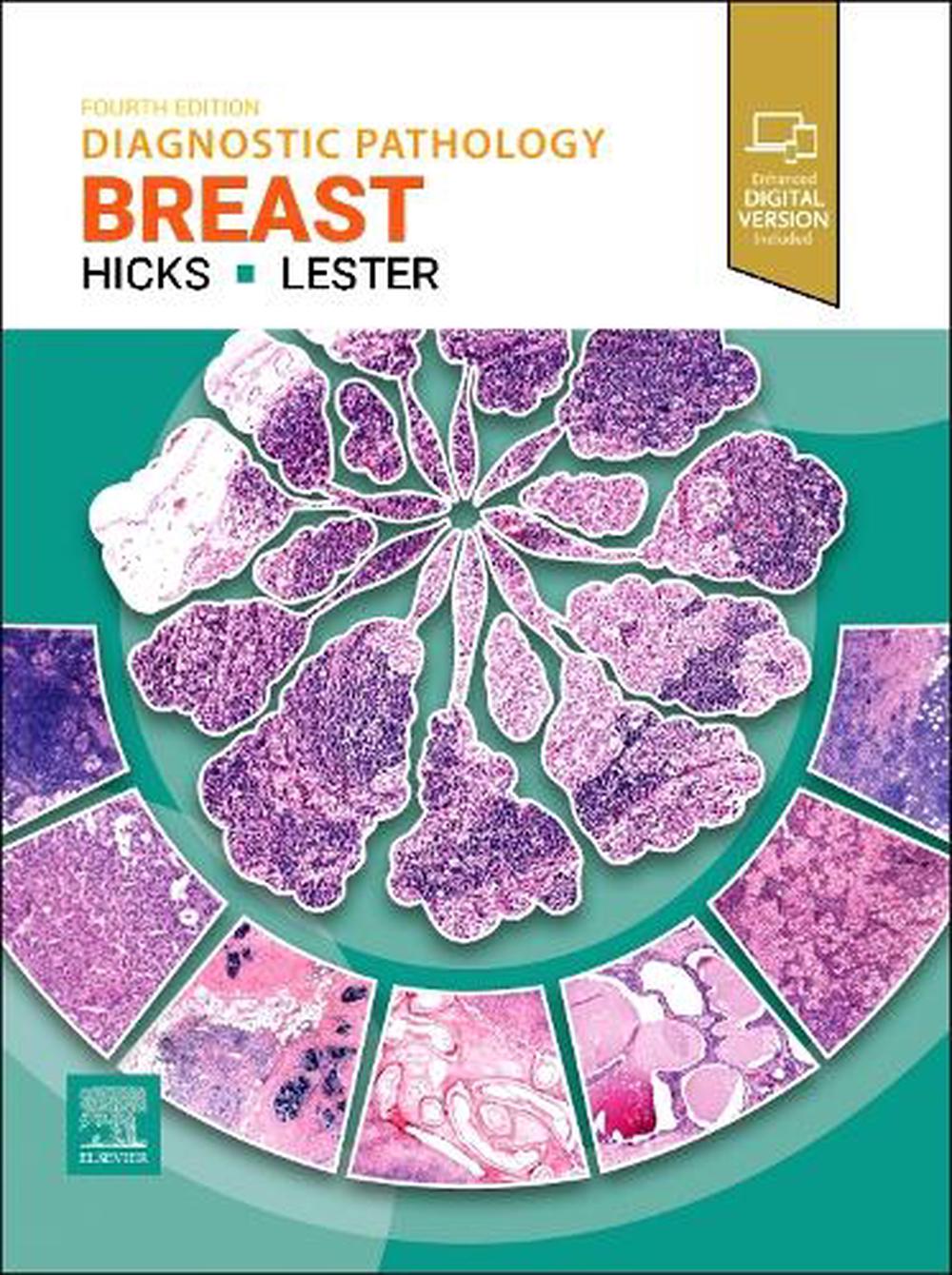 Diagnostic Pathology: Breast, 9780443286810