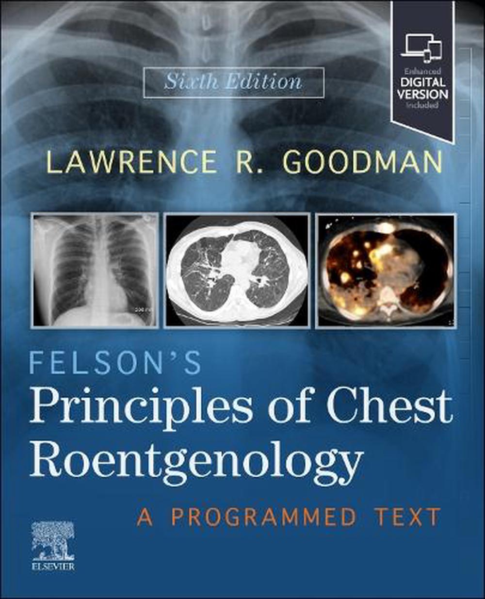 Felson's Principles of Chest Roentgenology, 6th Edition, 9780443287091