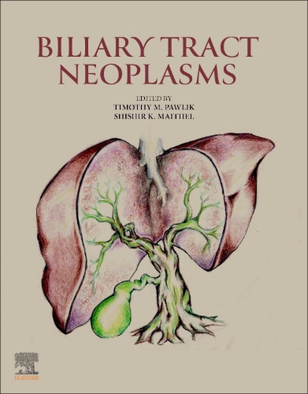 Biliary Tract Neoplasms, 9780443292873