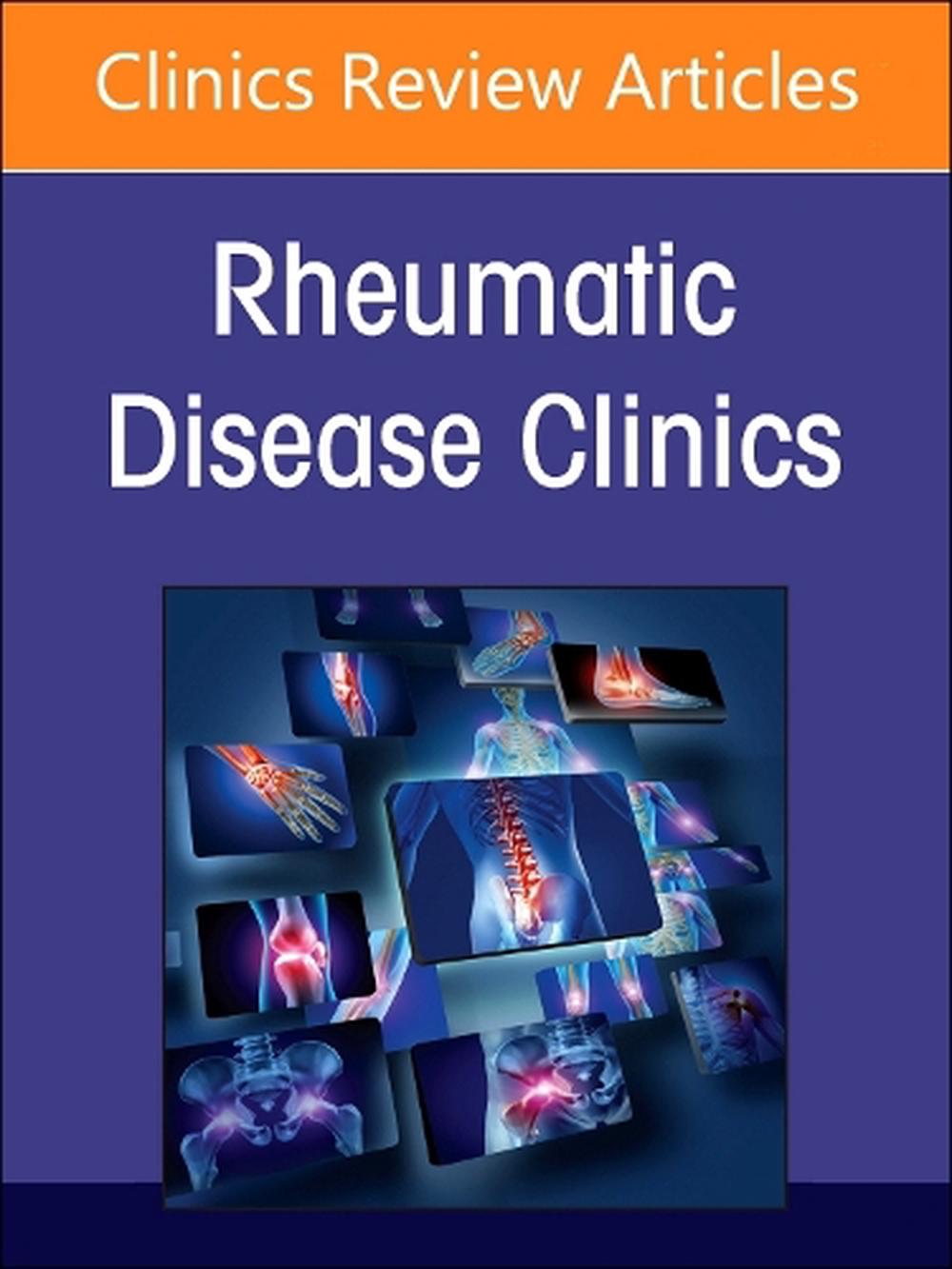 Rheumatic immune-related adverse events, An Issue of Rheumatic Disease Clinics of North America, 9780443294006
