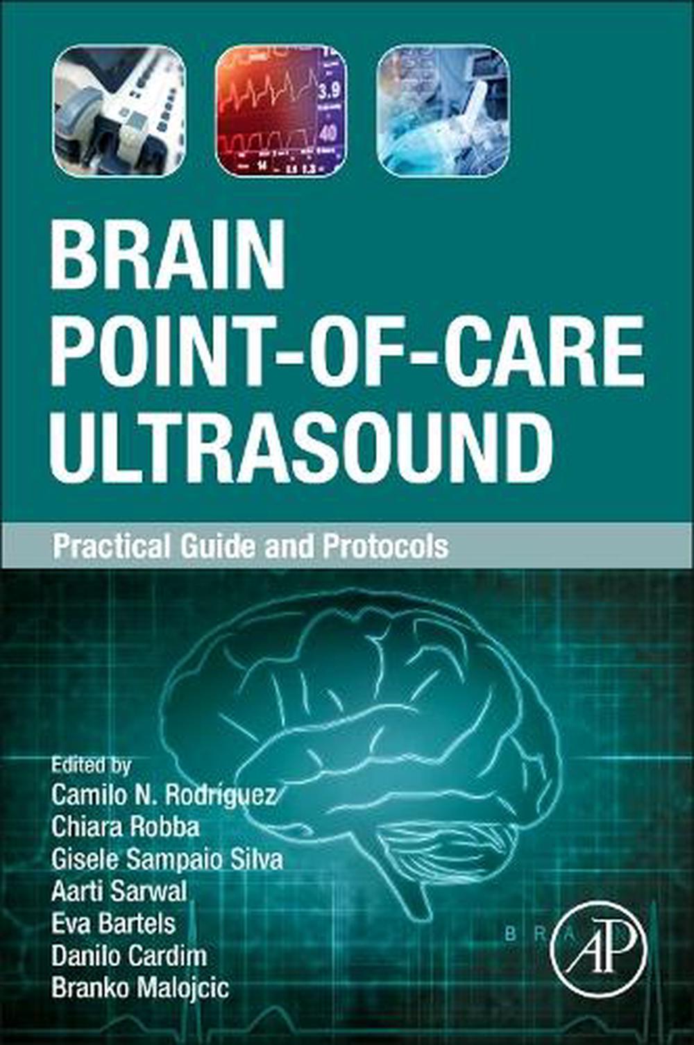 Brain Point-of-Care Ultrasound by Camilo N. Rodríguez - ISBN: 9780443337857
