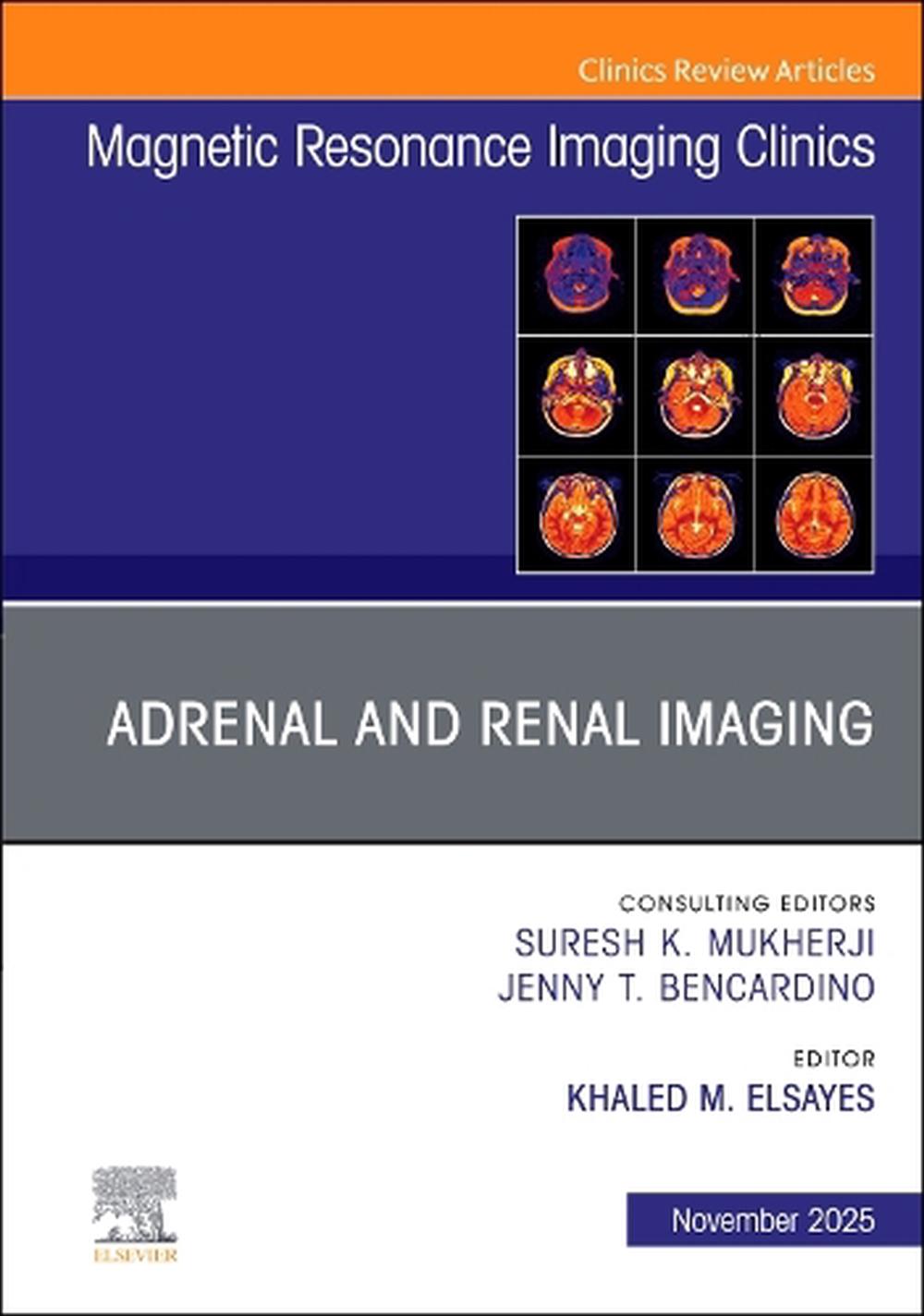 Adrenal and Renal Imaging, An Issue of Magnetic Resonance Imaging Clinics of North America, 9780443346132