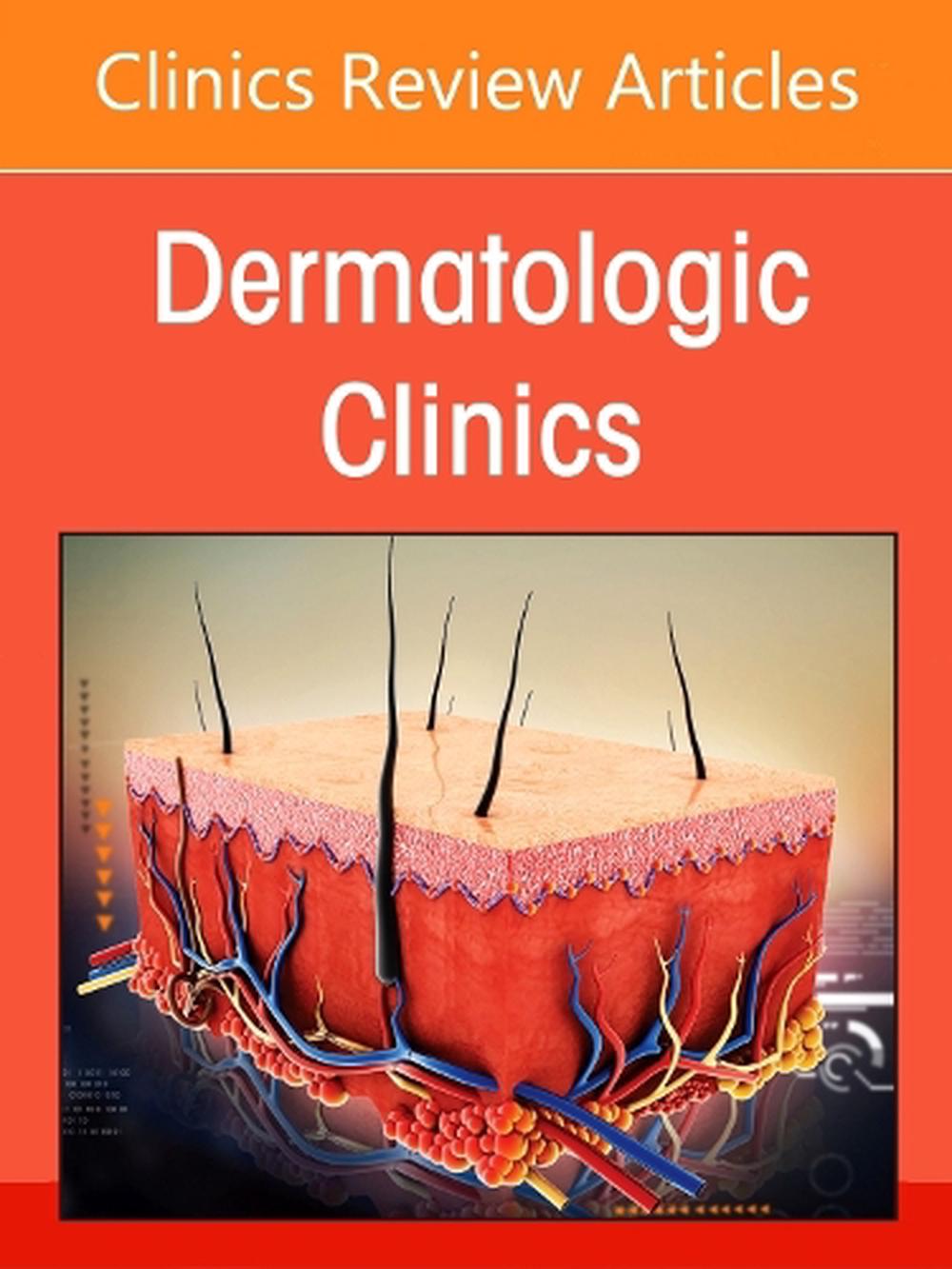 Artificial Intelligence in Dermatology, An Issue of Dermatologic Clinics, 9780443346972