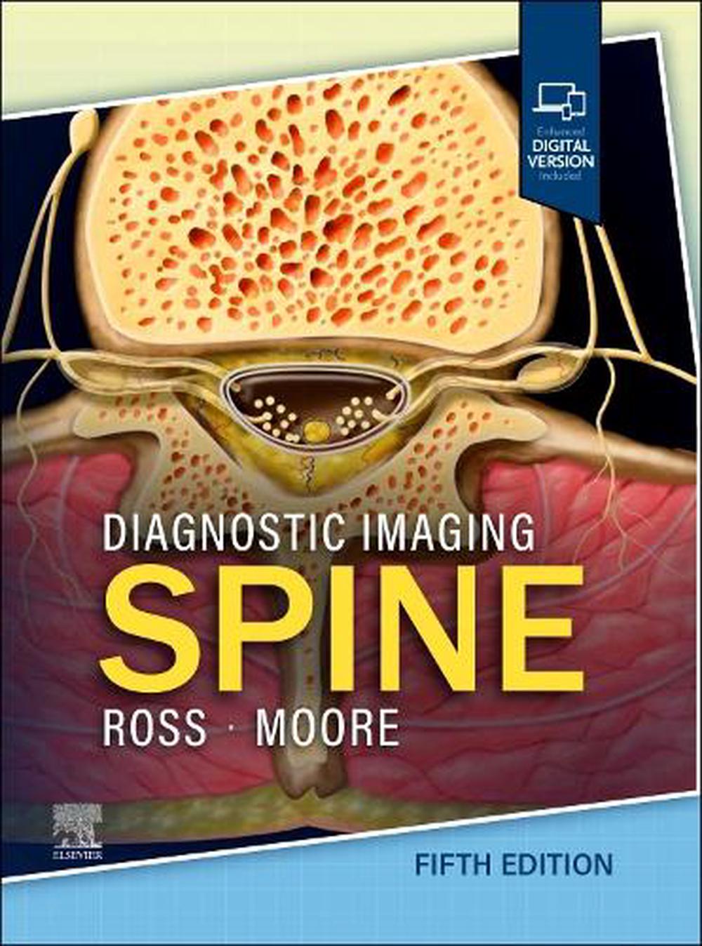 Diagnostic Imaging: Spine, 9780443378812