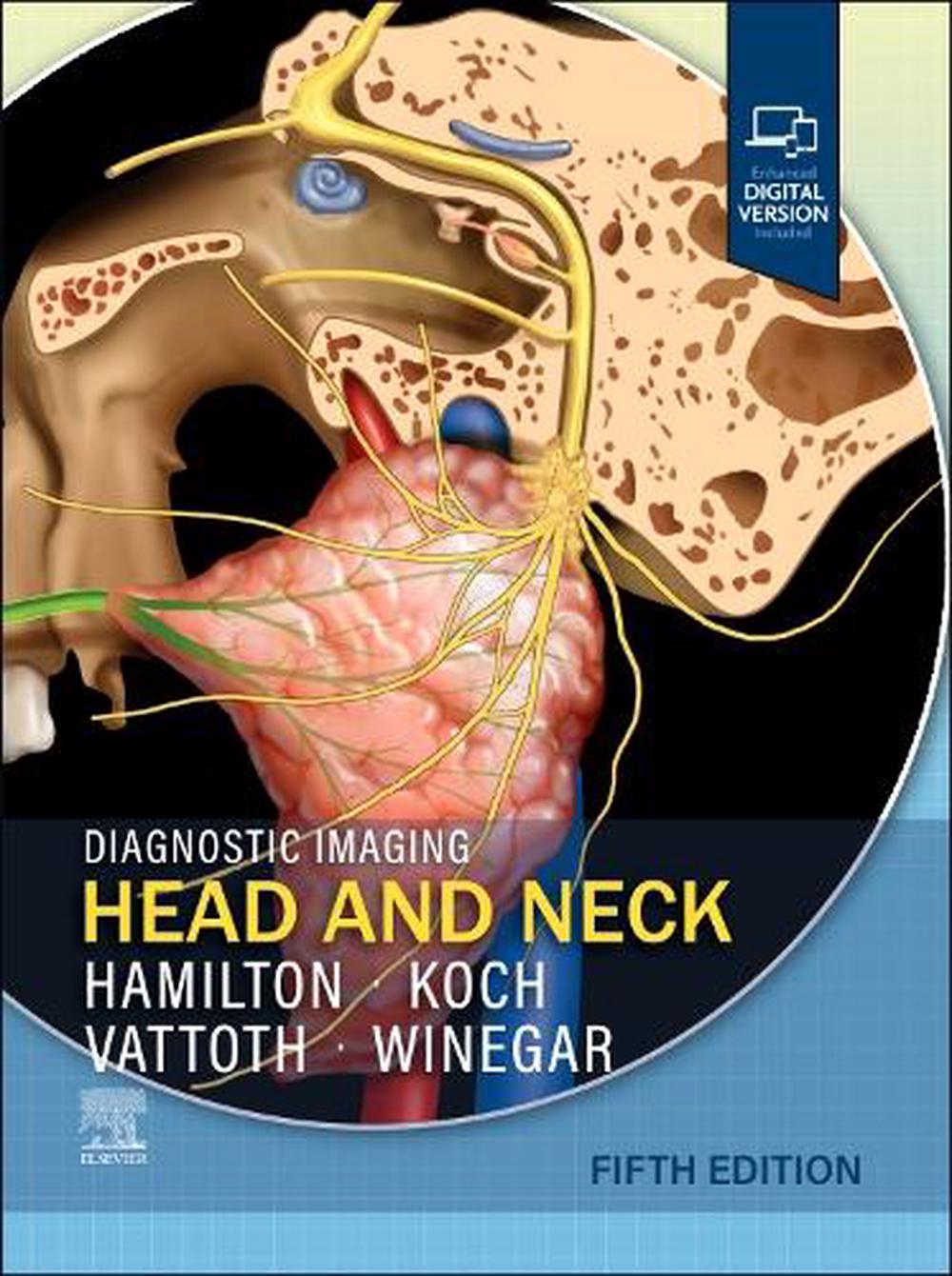 Diagnostic Imaging: Head and Neck, 9780443378904