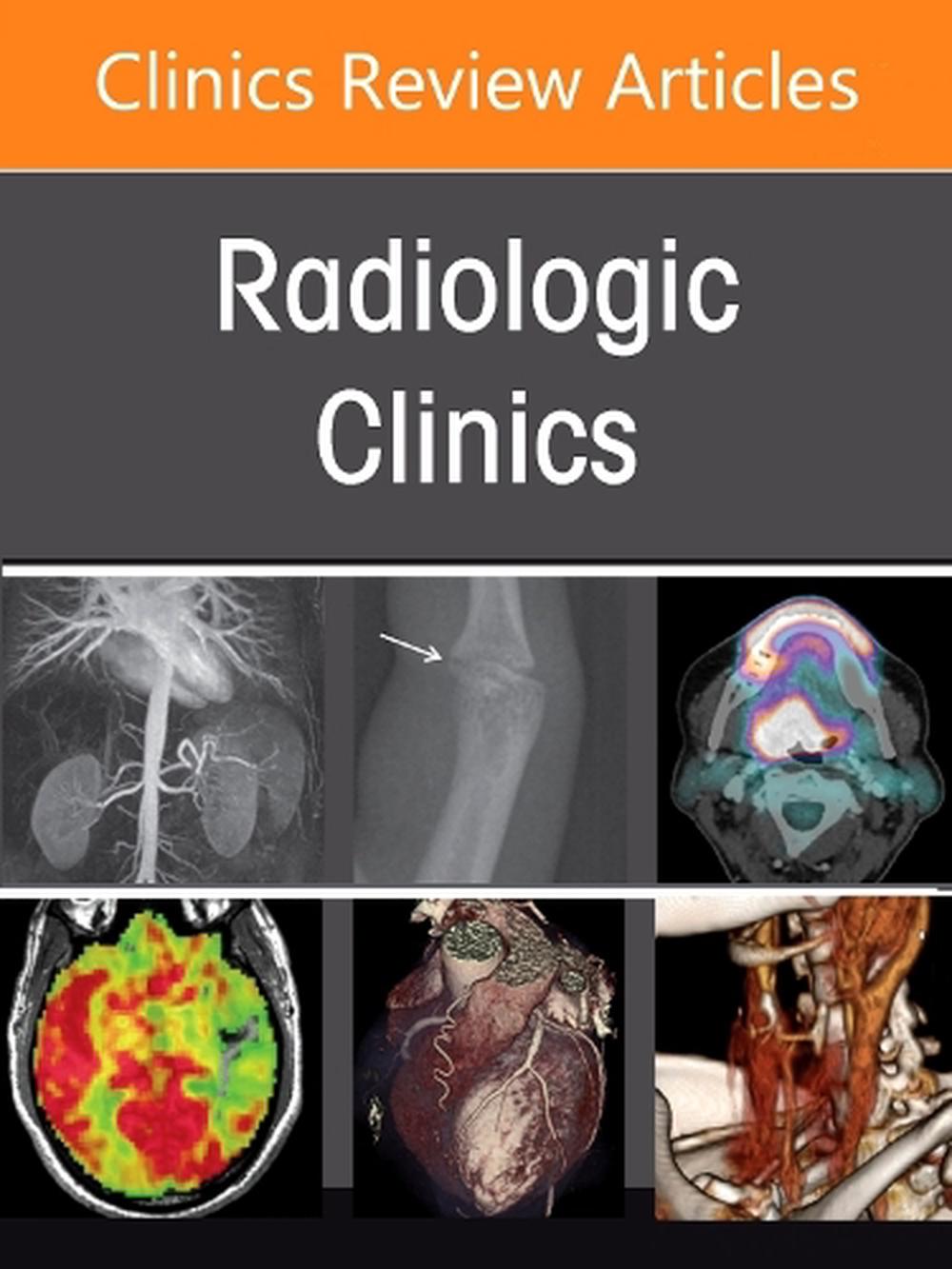 Imaging of the Orbit, An Issue of Radiologic Clinics of North America, 9780443430312