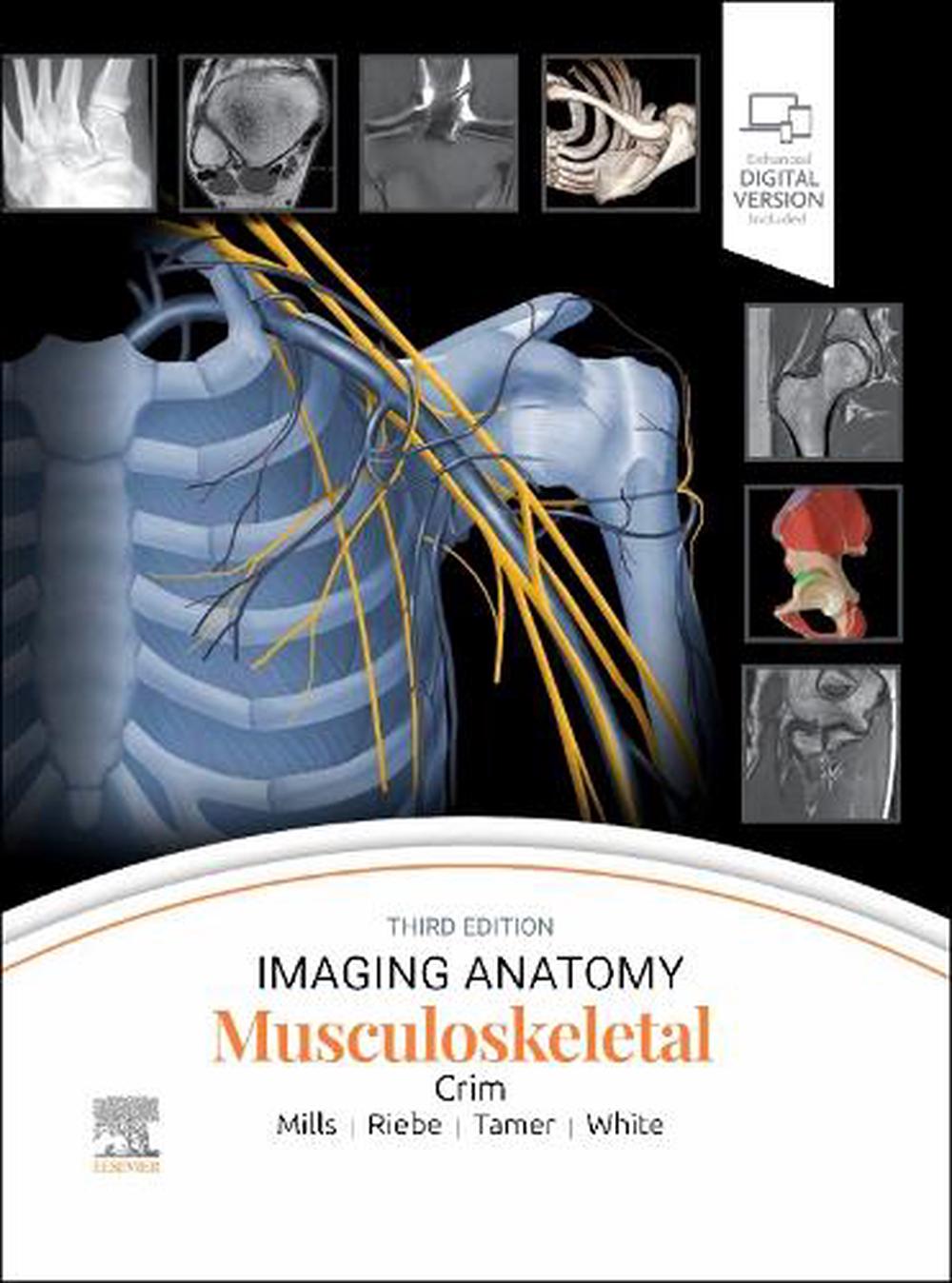 Imaging Anatomy: Musculoskeletal, 3rd Edition, 9780443433450