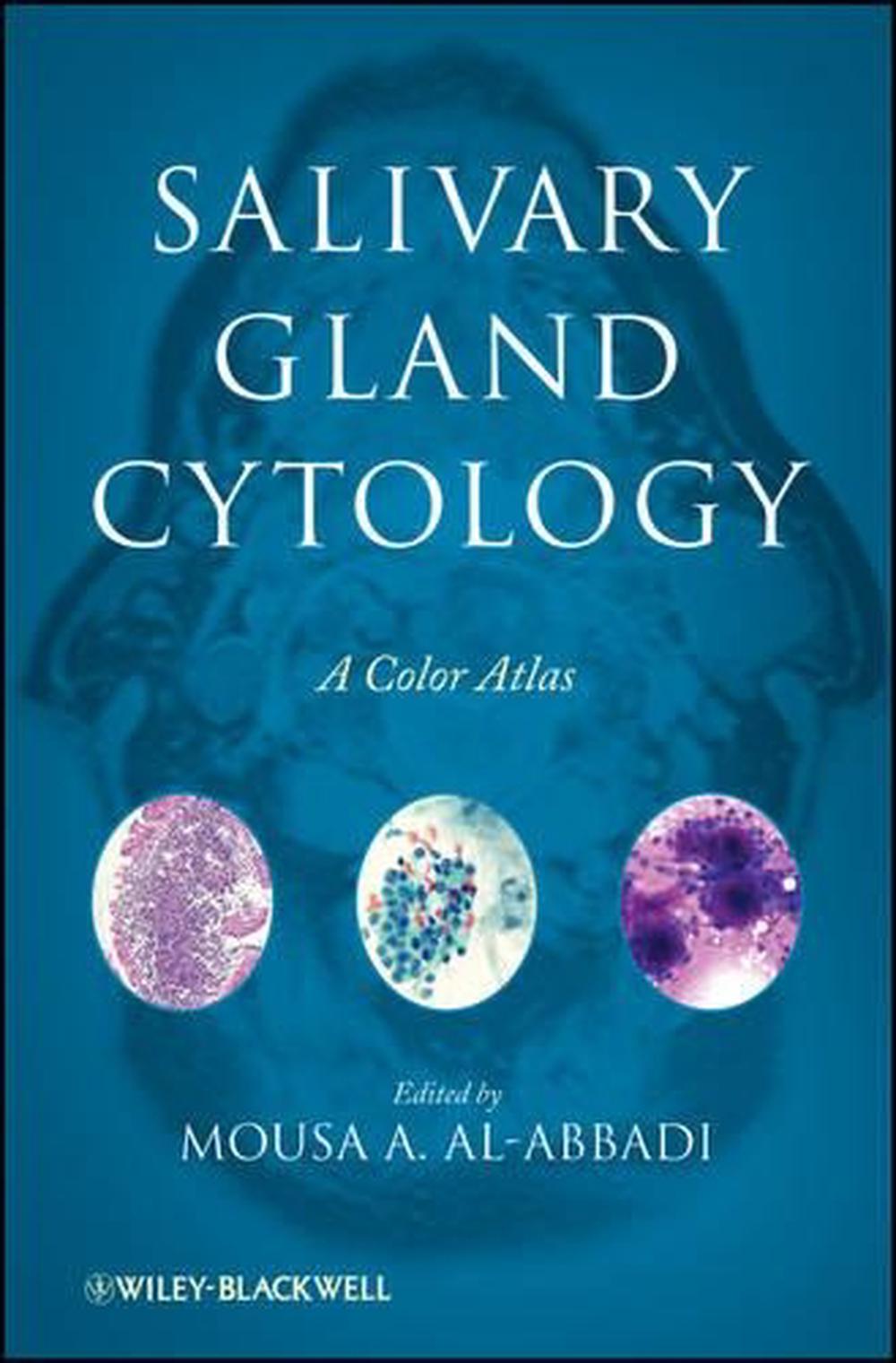 Salivary Gland Cytology, 9780470500927