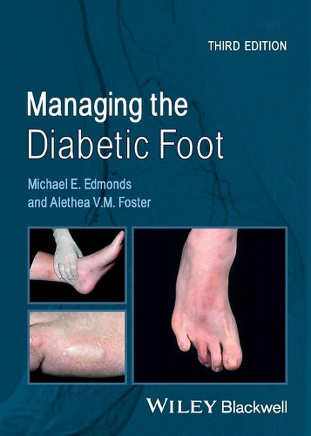 Managing the Diabetic Foot, 9780470655054