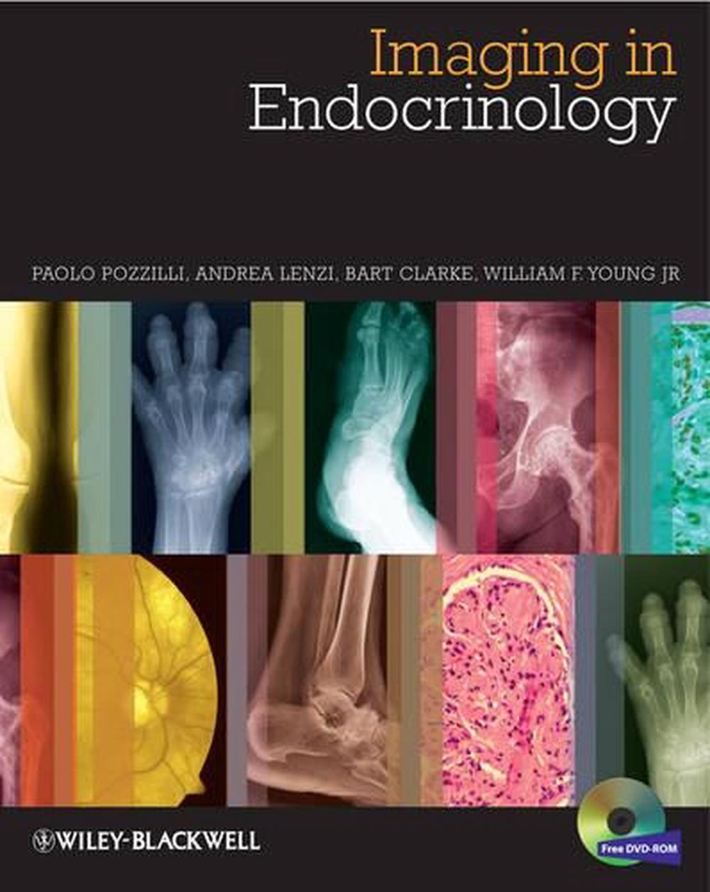 Imaging in Endocrinology, 9780470656273