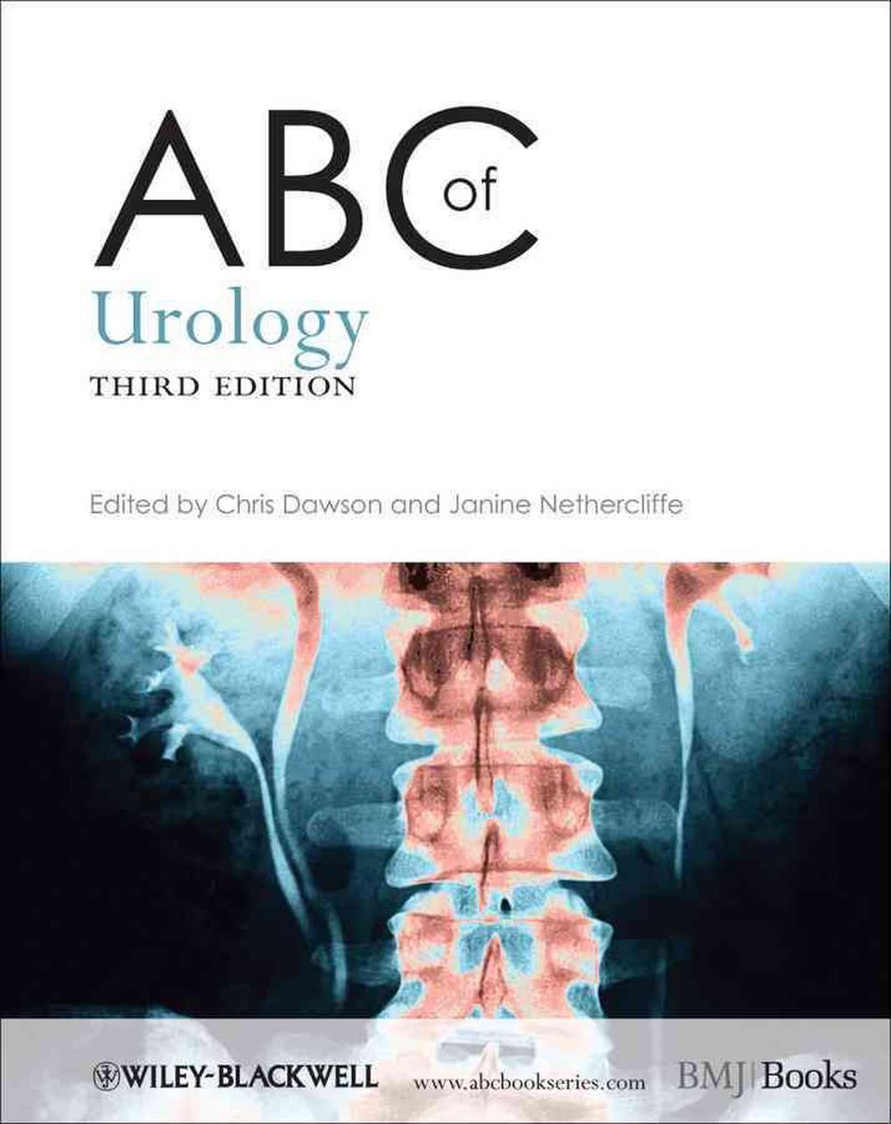 ABC of Urology, 9780470657171