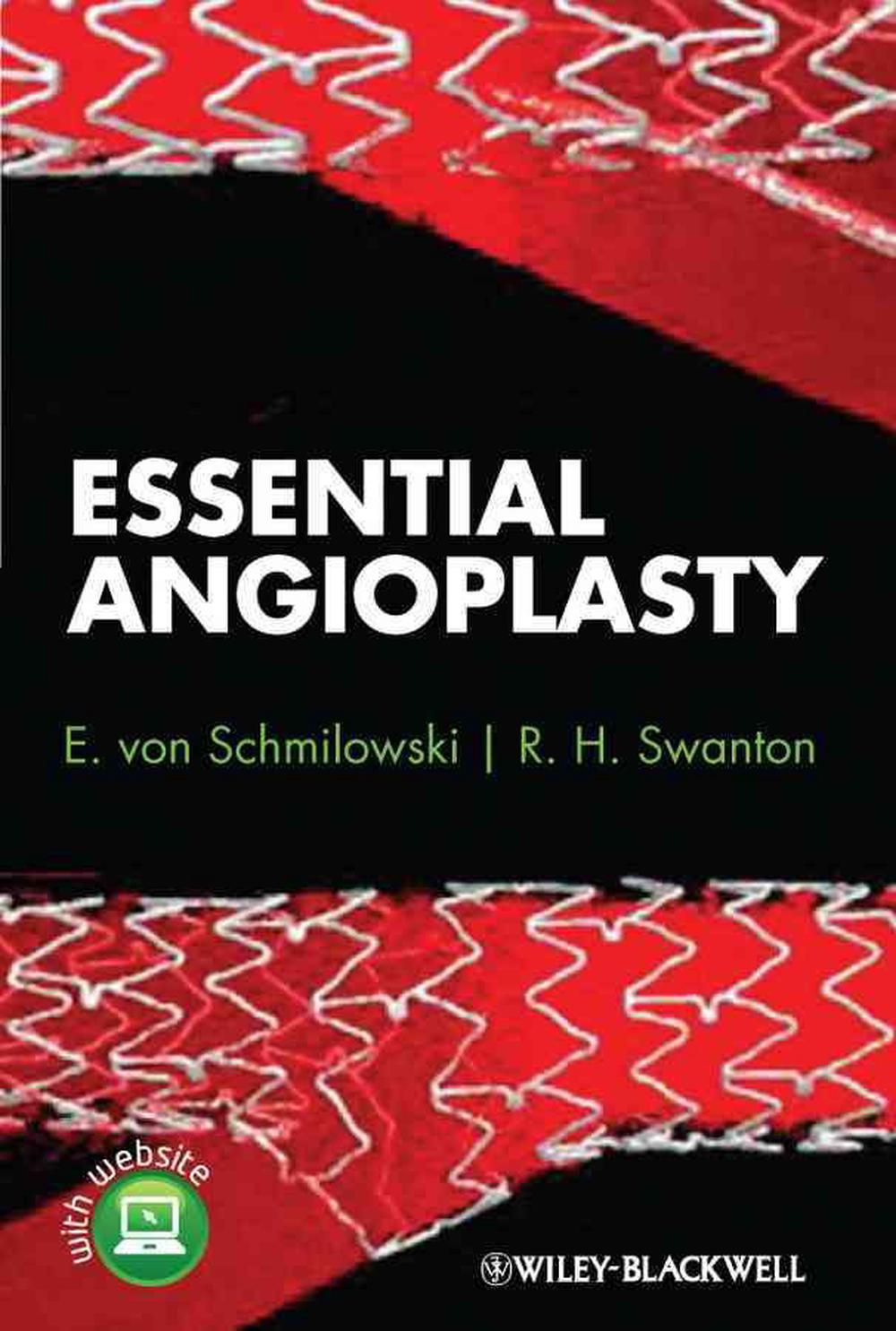 Essential Angioplasty, 9780470657263