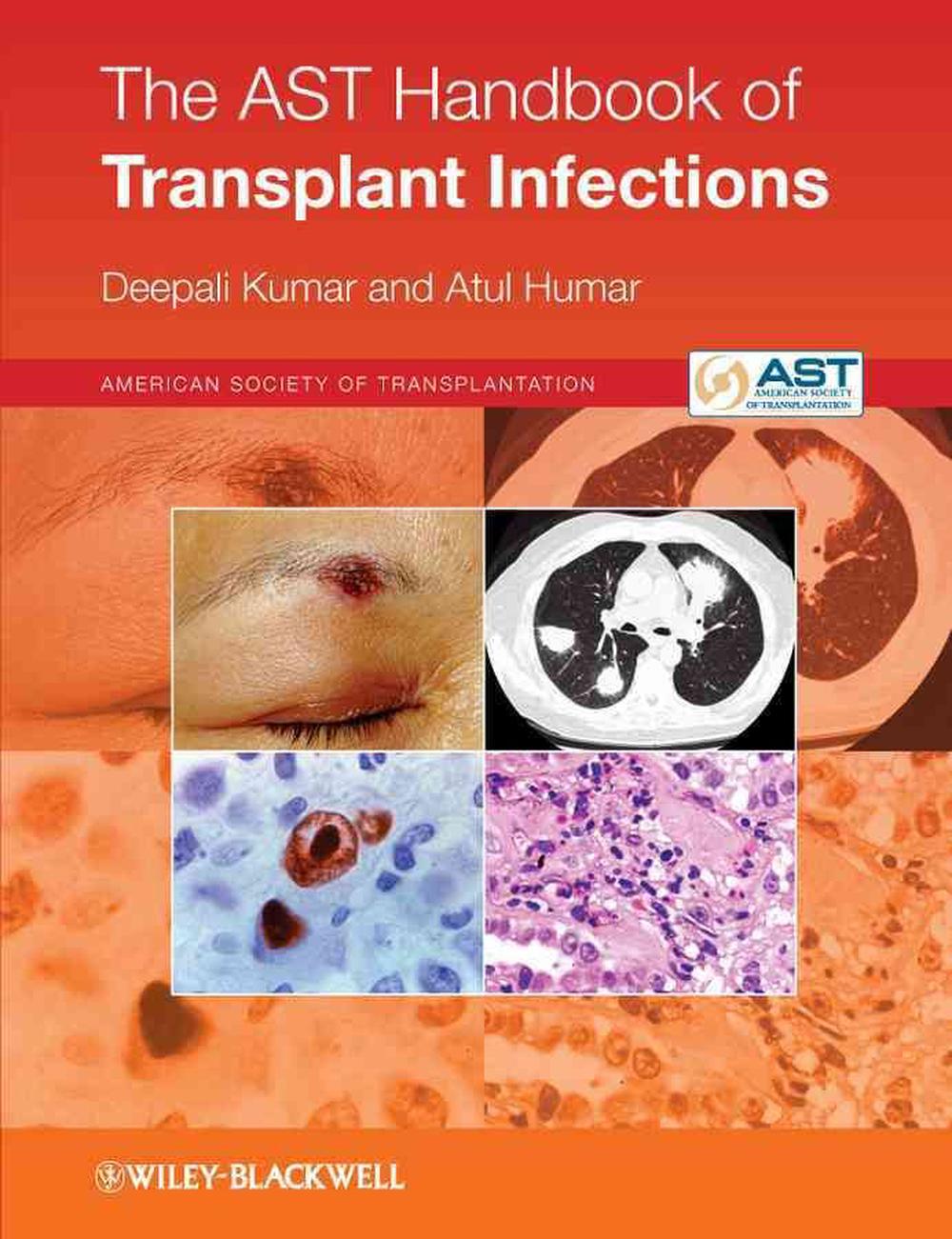 The AST Handbook of Transplant Infections, 9780470658277