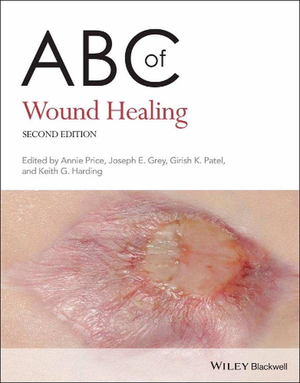 ABC of Wound Healing, 9780470658970