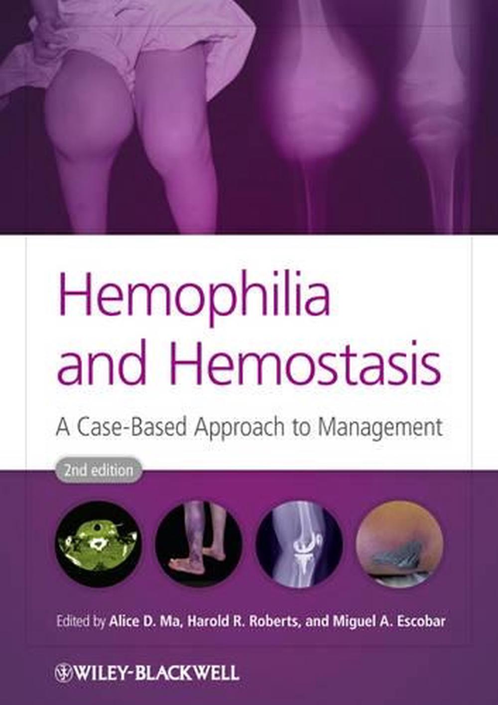 Hemophilia and Hemostasis, 2nd Edition, 9780470659762