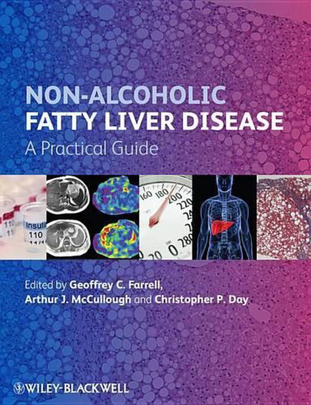 Non-Alcoholic Fatty Liver Disease, 2nd Edition, 9780470673171