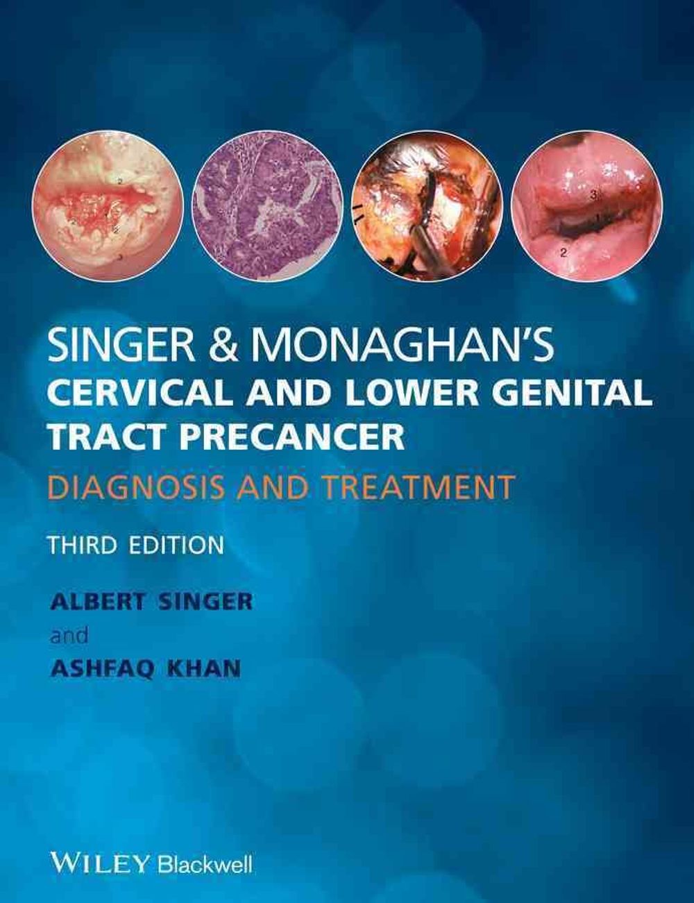 Singer and Monaghan's Cervical and Lower Genital Tract Precancer, 3rd ...