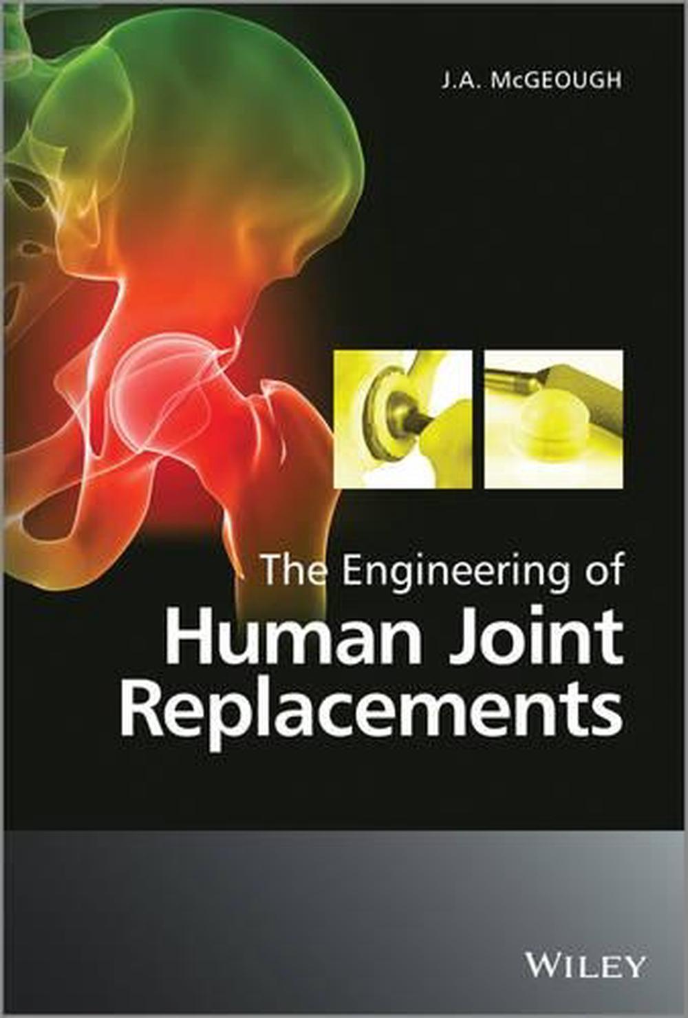 The Engineering of Human Joint Replacements, 1st Edition, 9780470740279