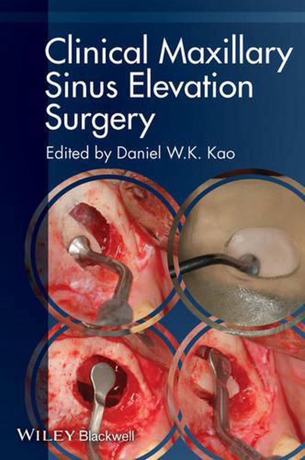 Clinical Maxillary Sinus Elevation Surgery, 9780470960738
