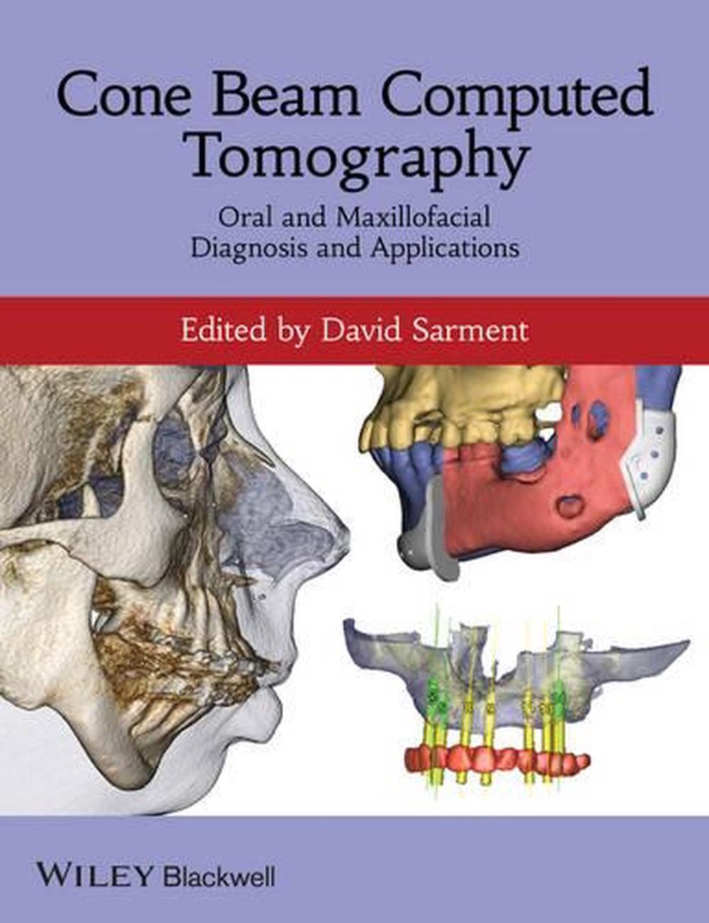 Cone Beam Computed Tomography, 9780470961407