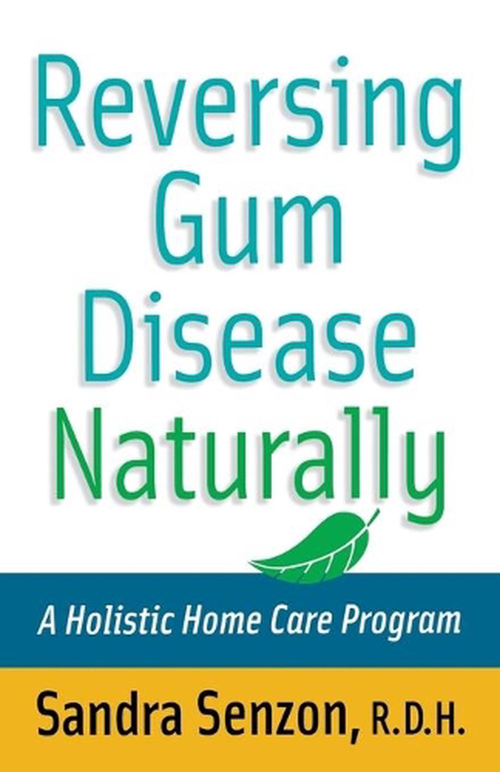 Reversing Gum Disease Naturally, 1st Edition, 9780471222309