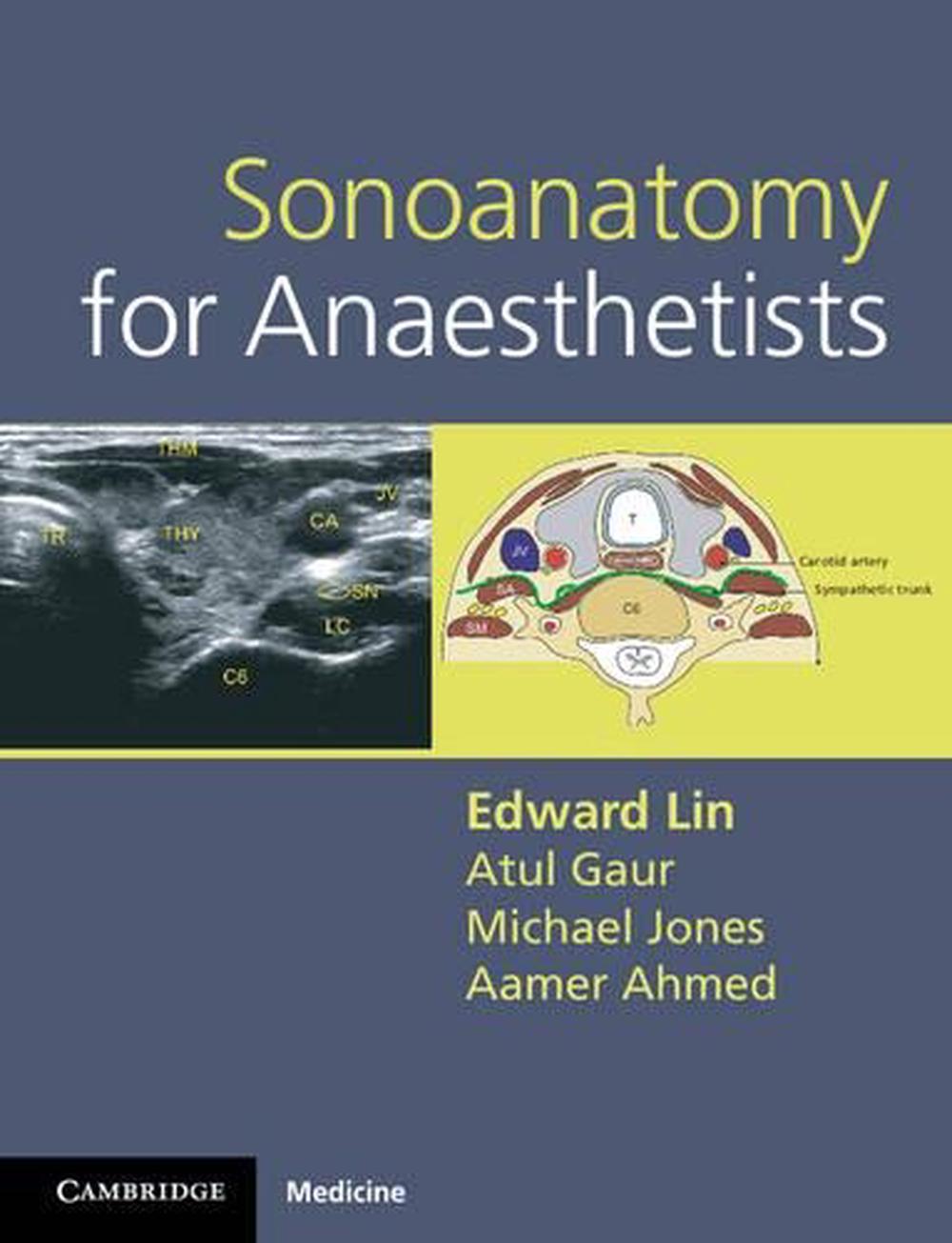 Sonoanatomy for Anaesthetists, 9780521106665