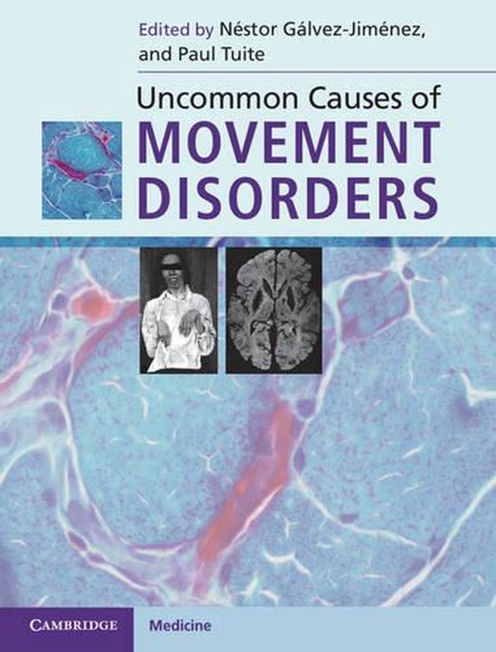 Uncommon Causes of Movement Disorders, 9780521111546