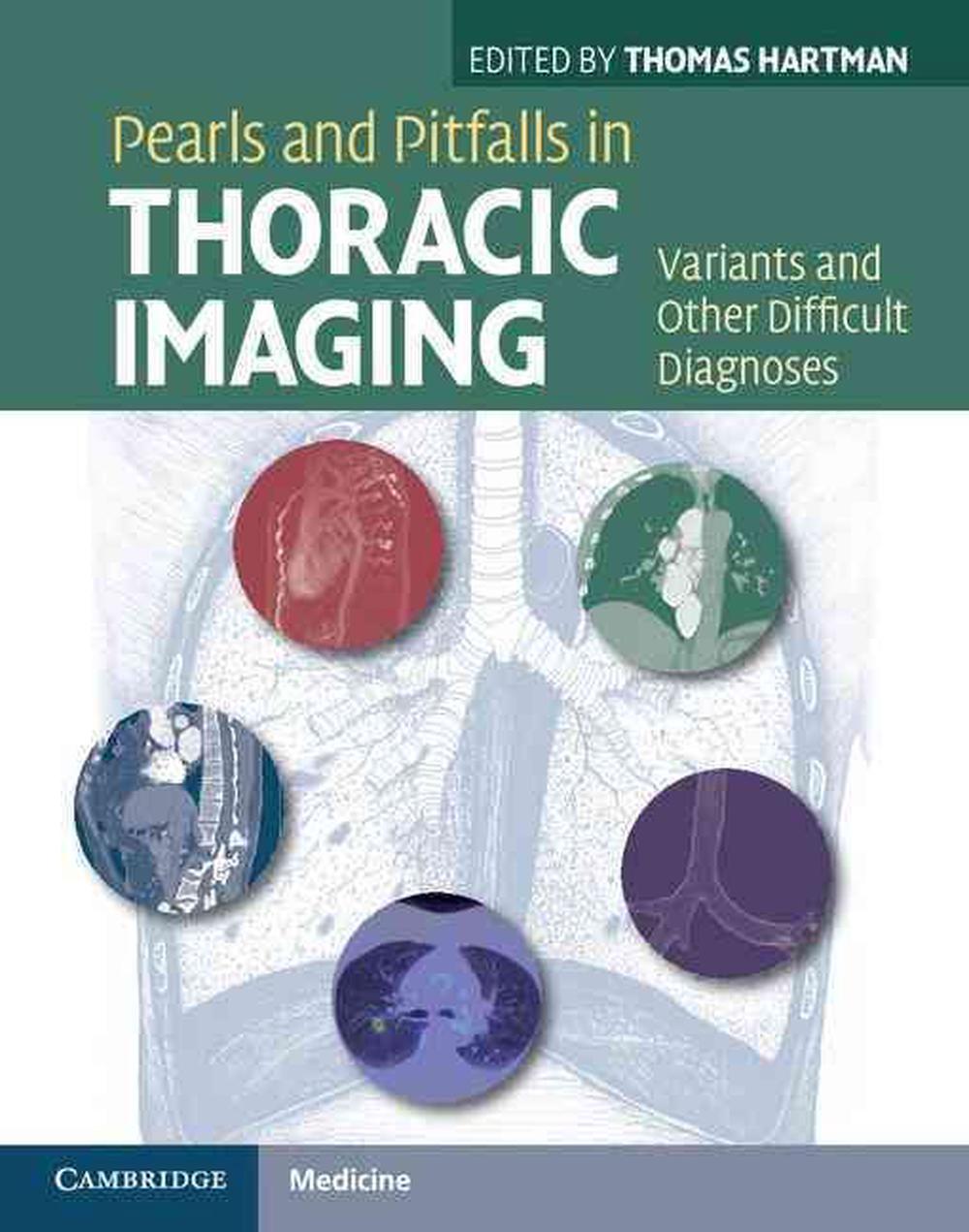 Pearls and Pitfalls in Thoracic Imaging, 9780521119078
