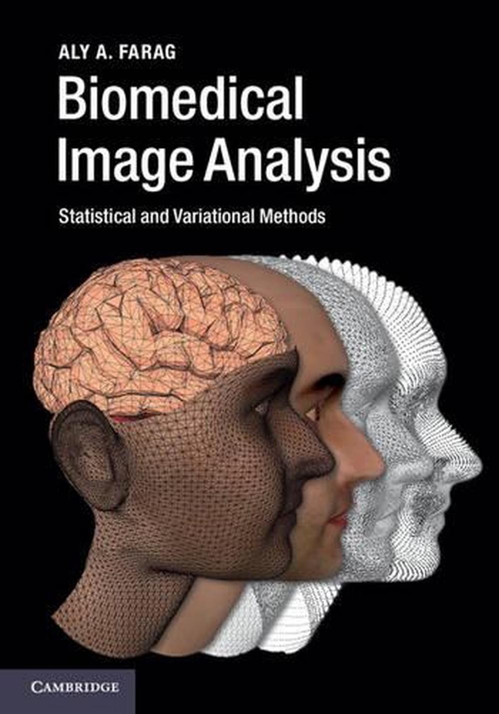 Biomedical Image Analysis, 9780521196796