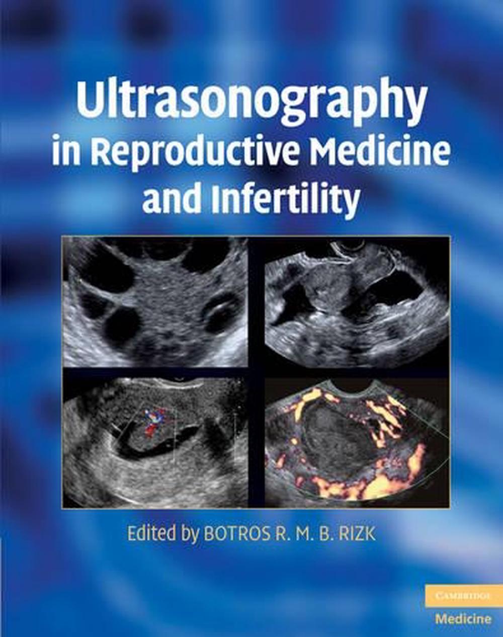 Ultrasonography in Reproductive Medicine and Infertility, 9780521509763