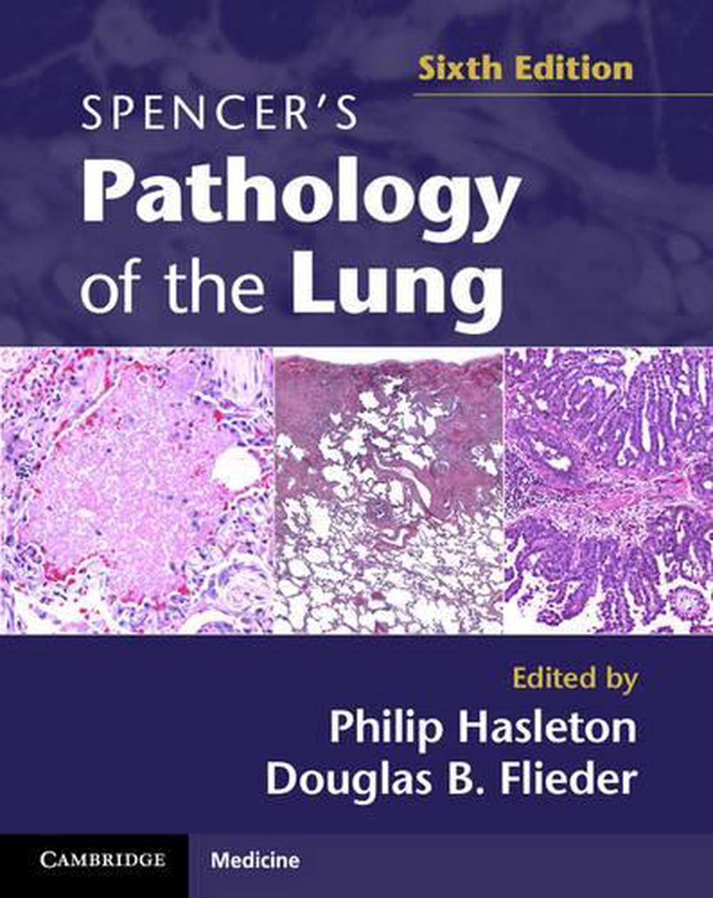 Spencer's Pathology Of The Lung 2 Part Set With Dvds By Philip Hasleton 